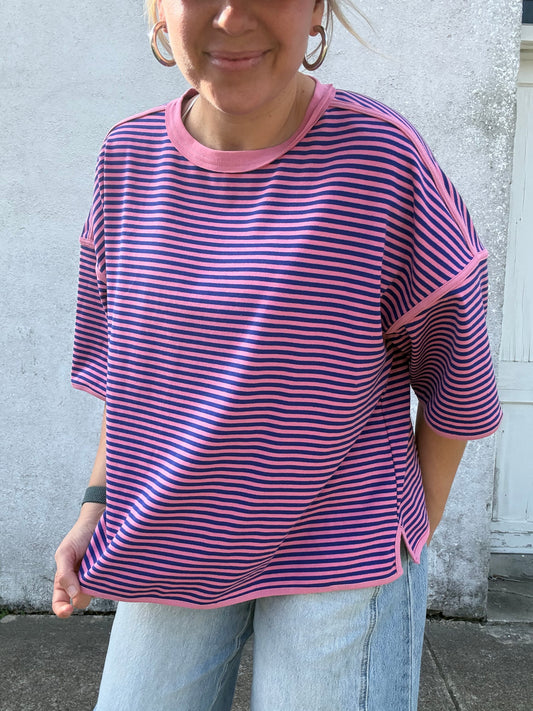 Striped Oversized Top